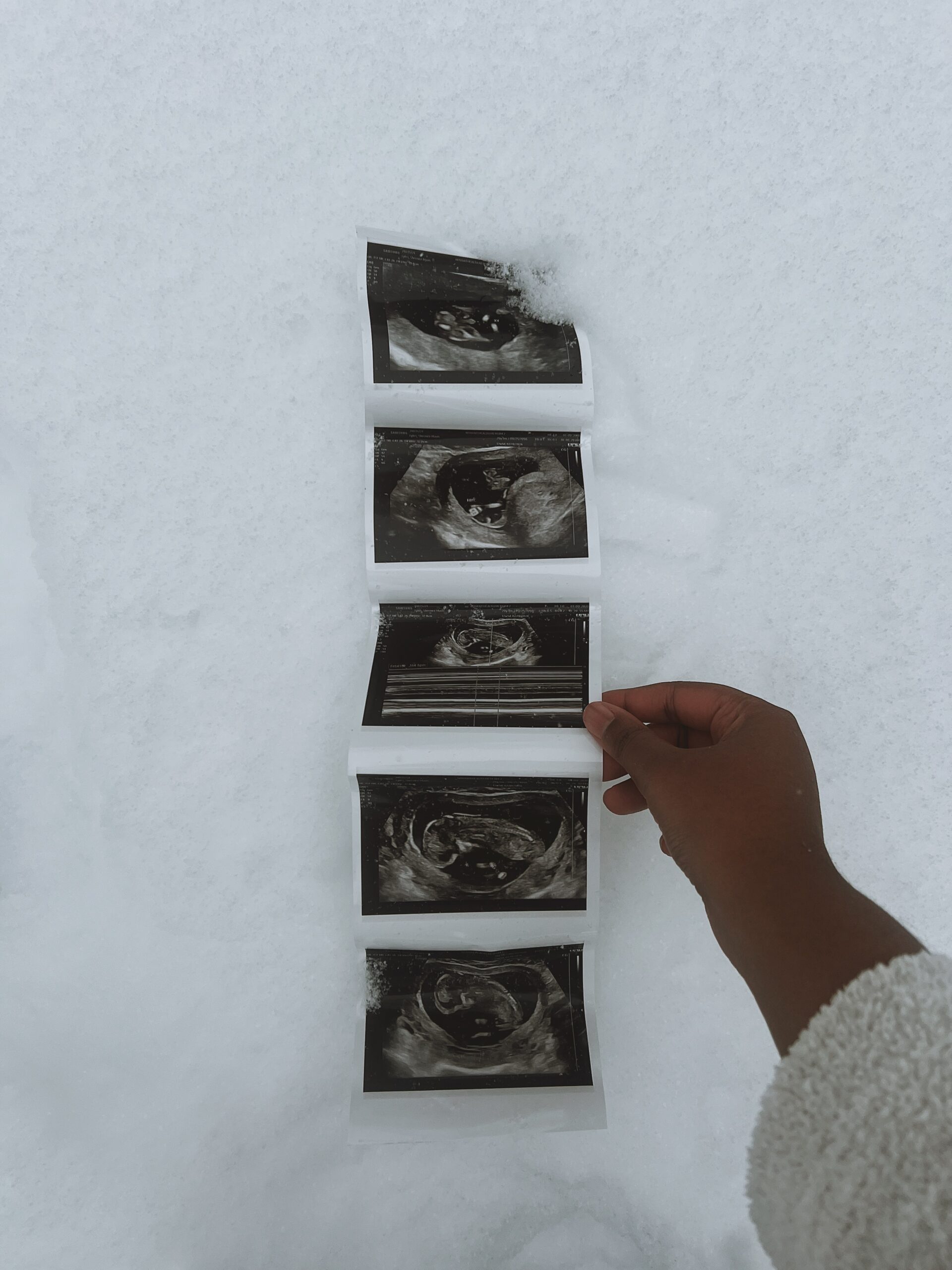 A photo of an ultrasound laid flat